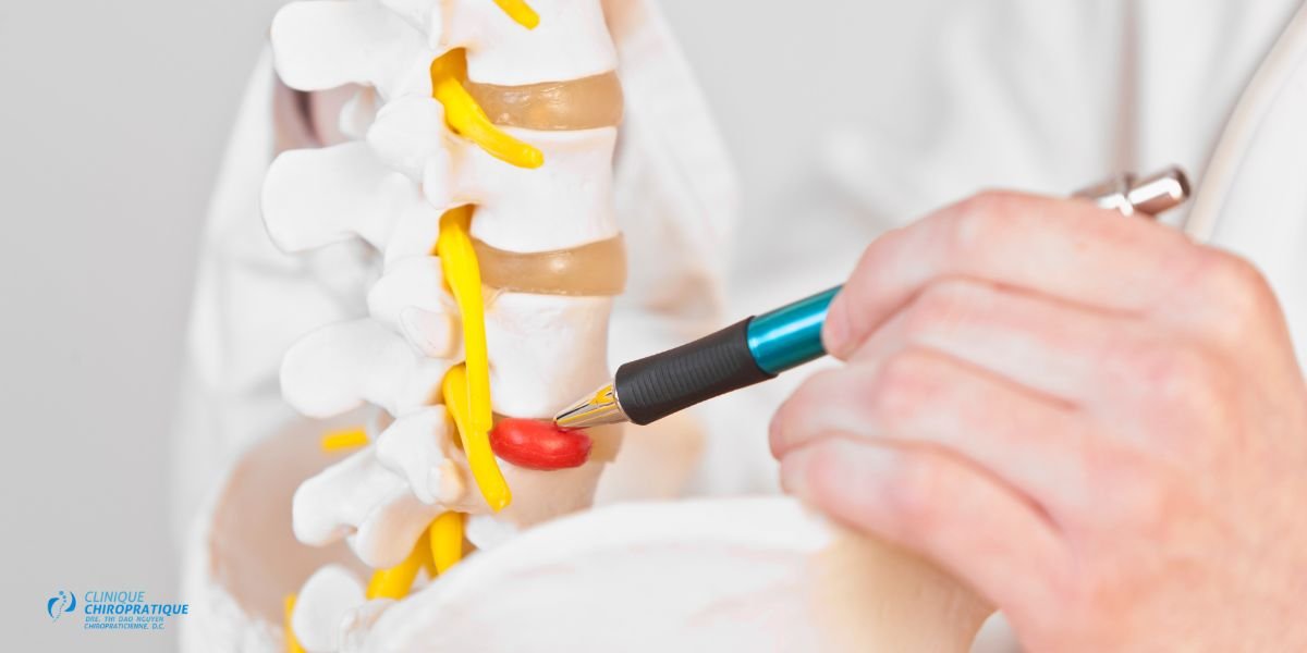 hernie-cervicale-chiropraticien-a-montreal